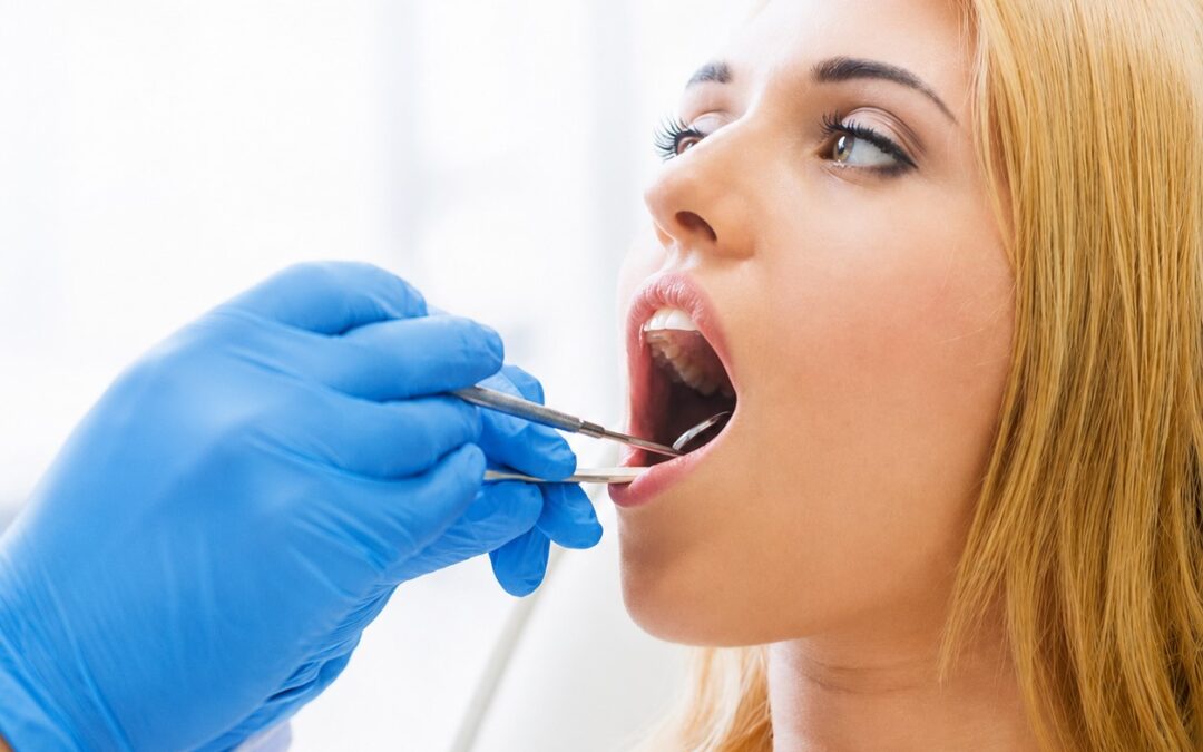 Oral Cancer Screening