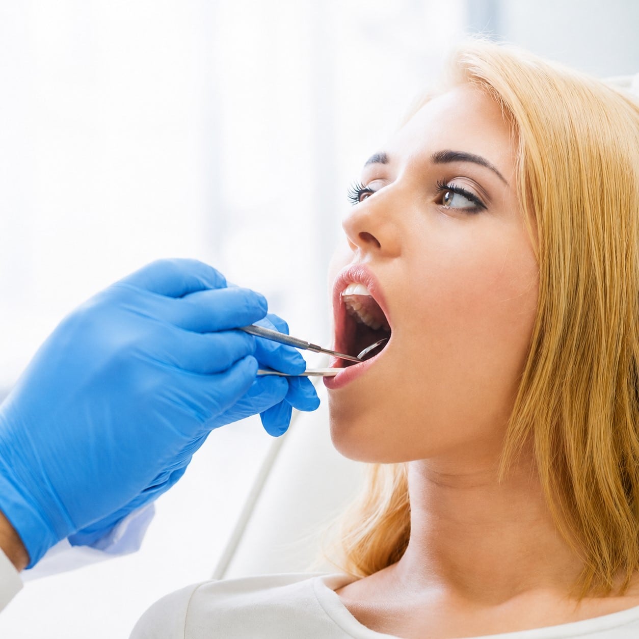 Oral Cancer Screening